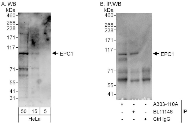 EPC1 Antibody in Western Blot (WB)