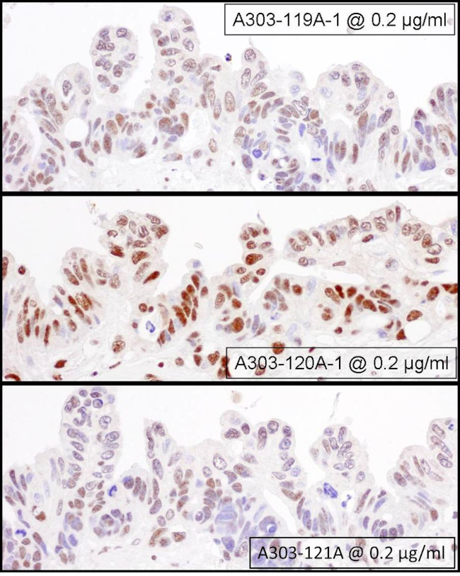 NF90/NF110 Antibody in Immunohistochemistry (Paraffin) (IHC (P))