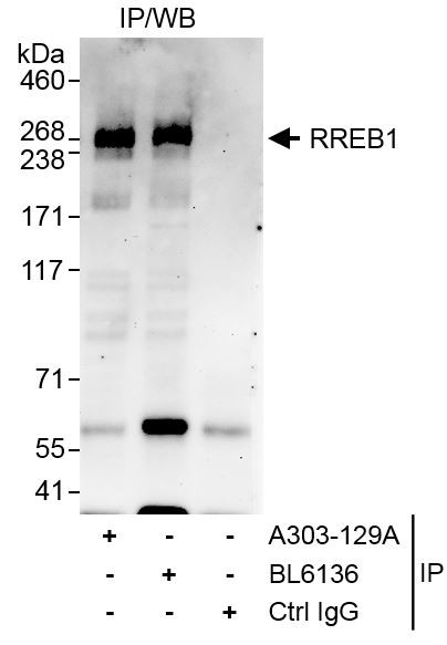 RREB1 Antibody in Immunoprecipitation (IP)