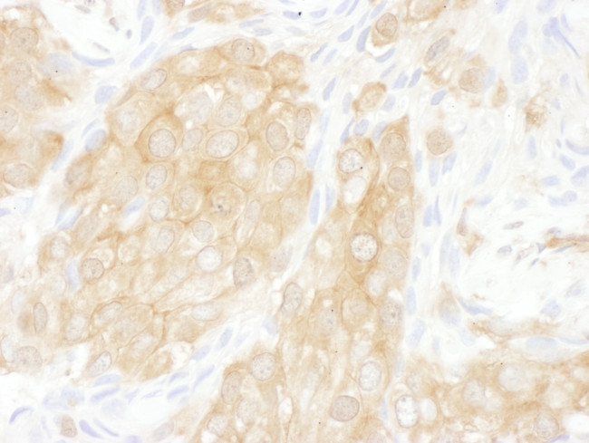 14-3-3 theta Antibody in Immunohistochemistry (Paraffin) (IHC (P))