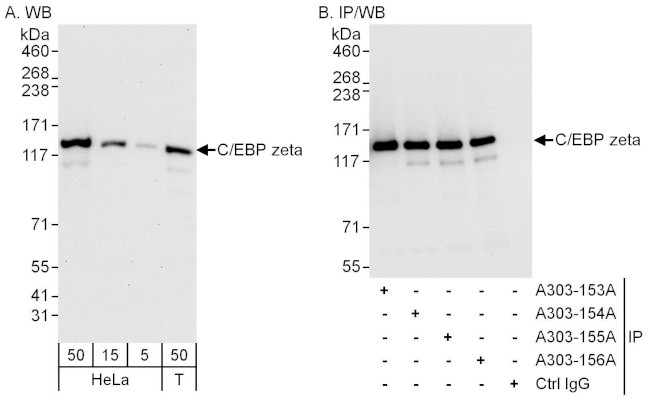 C/EBP zeta Antibody in Western Blot (WB)