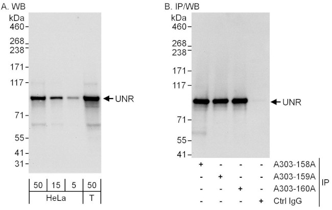 UNR Antibody in Western Blot (WB)