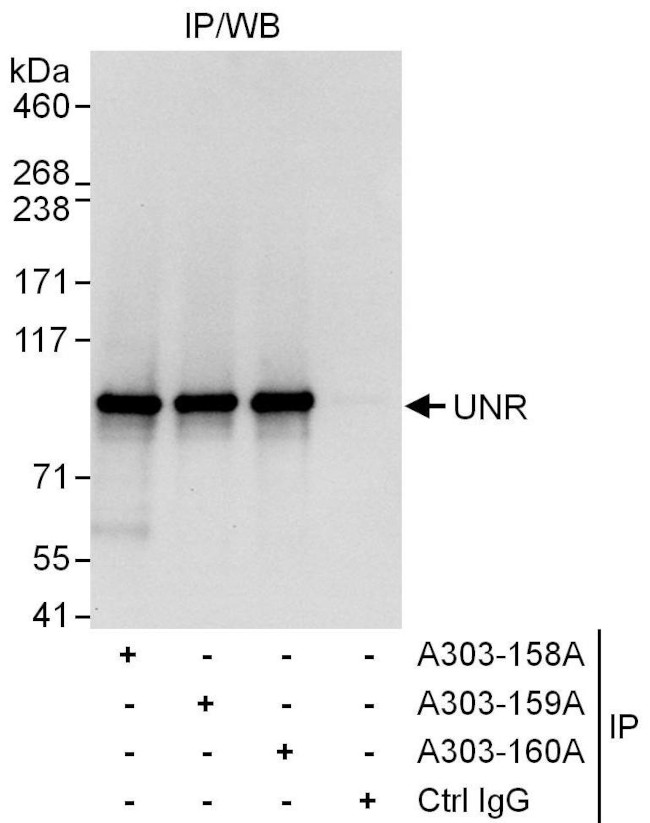 UNR Antibody in Immunoprecipitation (IP)