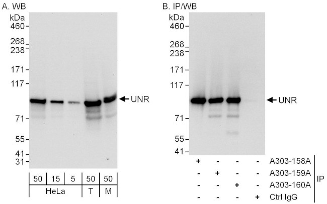 UNR Antibody in Western Blot (WB)