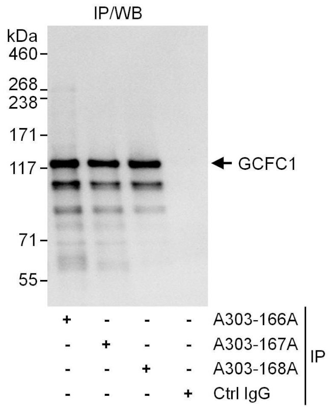 GCFC1 Antibody in Immunoprecipitation (IP)