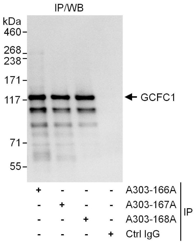 GCFC1 Antibody in Immunoprecipitation (IP)