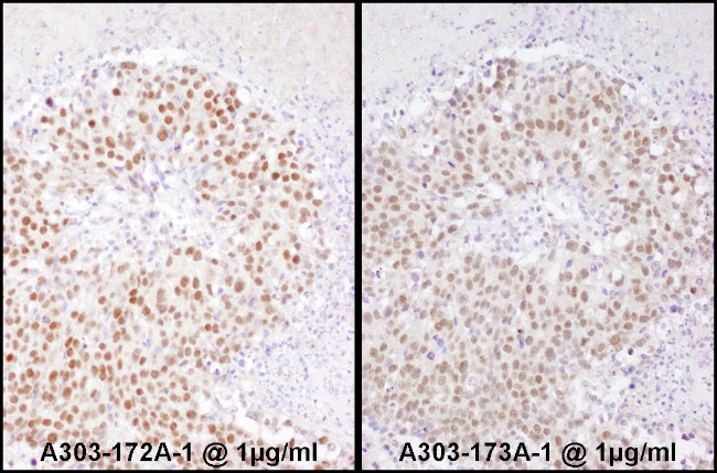 SRF Antibody in Immunohistochemistry (Paraffin) (IHC (P))