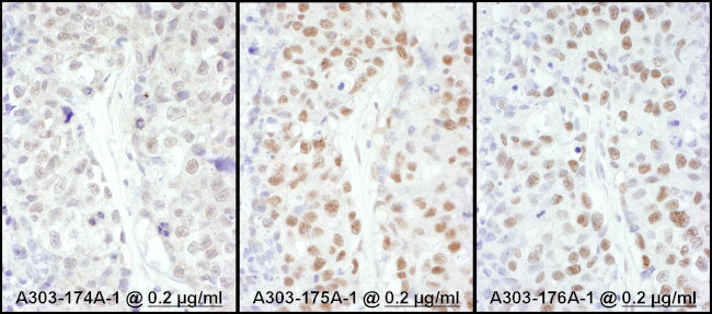 HSF1 Antibody in Immunohistochemistry (Paraffin) (IHC (P))