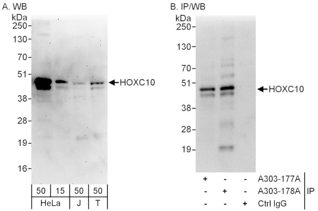 HOXC10 Antibody in Western Blot (WB)