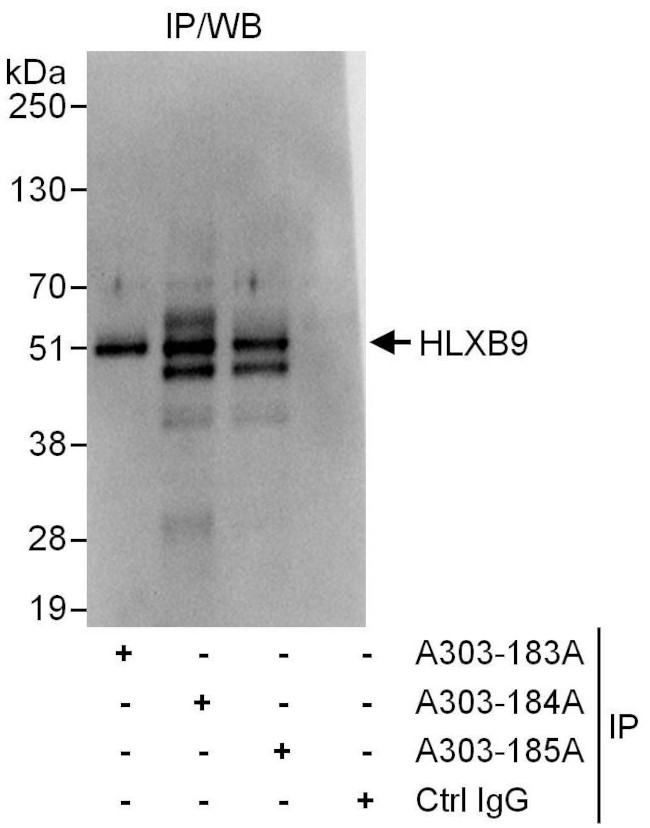 HLXB9 Antibody in Immunoprecipitation (IP)