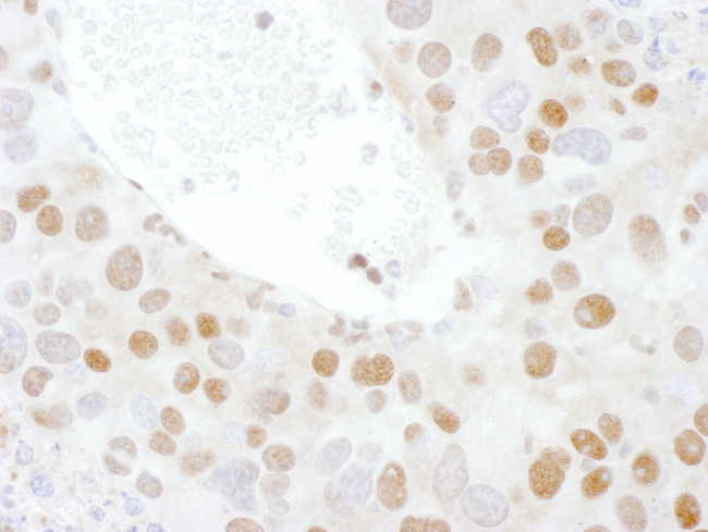 TDP43 Antibody in Immunohistochemistry (Paraffin) (IHC (P))