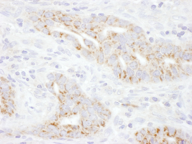 TXNIP Antibody in Immunohistochemistry (Paraffin) (IHC (P))