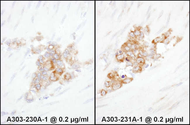 YB1 Antibody in Immunohistochemistry (Paraffin) (IHC (P))