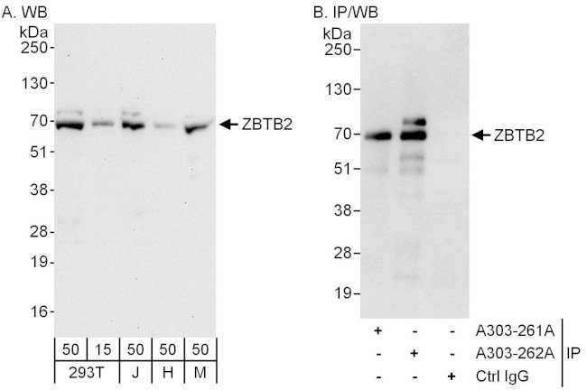 ZBTB2 Antibody in Western Blot (WB)