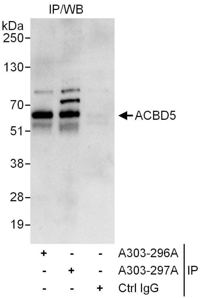 ACBD5 Antibody in Immunoprecipitation (IP)