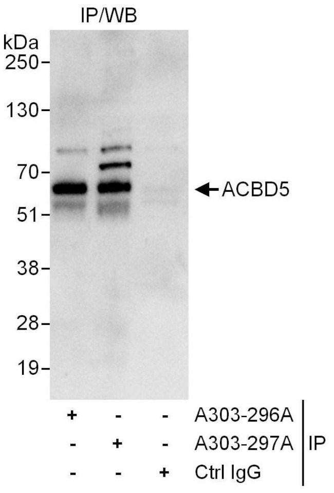 ACBD5 Antibody in Immunoprecipitation (IP)