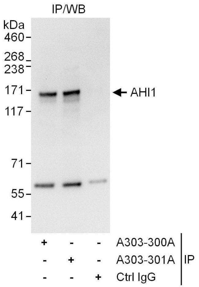 AHI1 Antibody in Immunoprecipitation (IP)