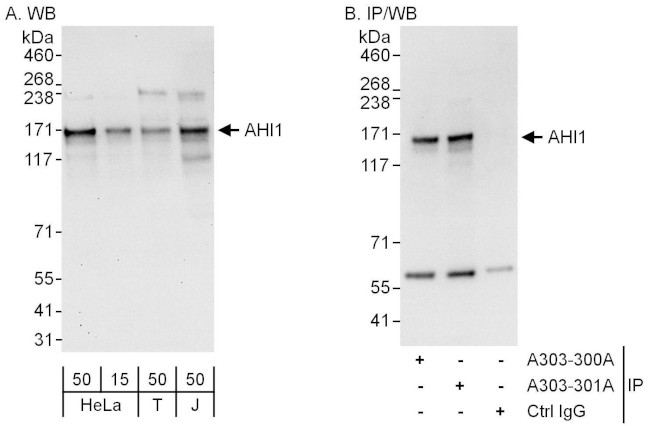 AHI1 Antibody in Western Blot (WB)