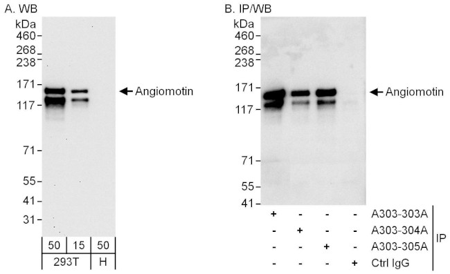 Angiomotin Antibody in Western Blot (WB)