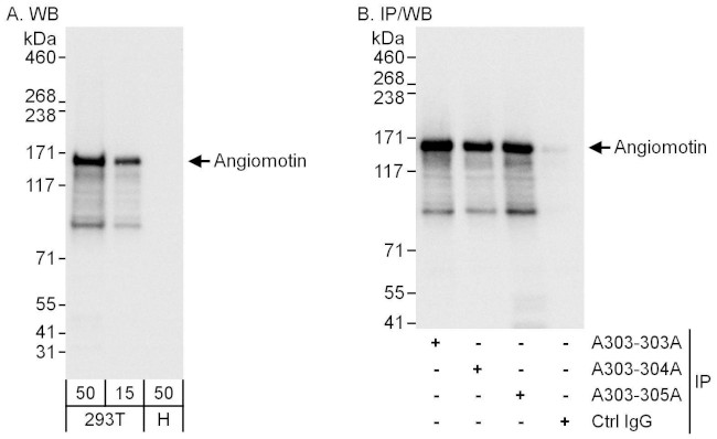 Angiomotin Antibody in Western Blot (WB)