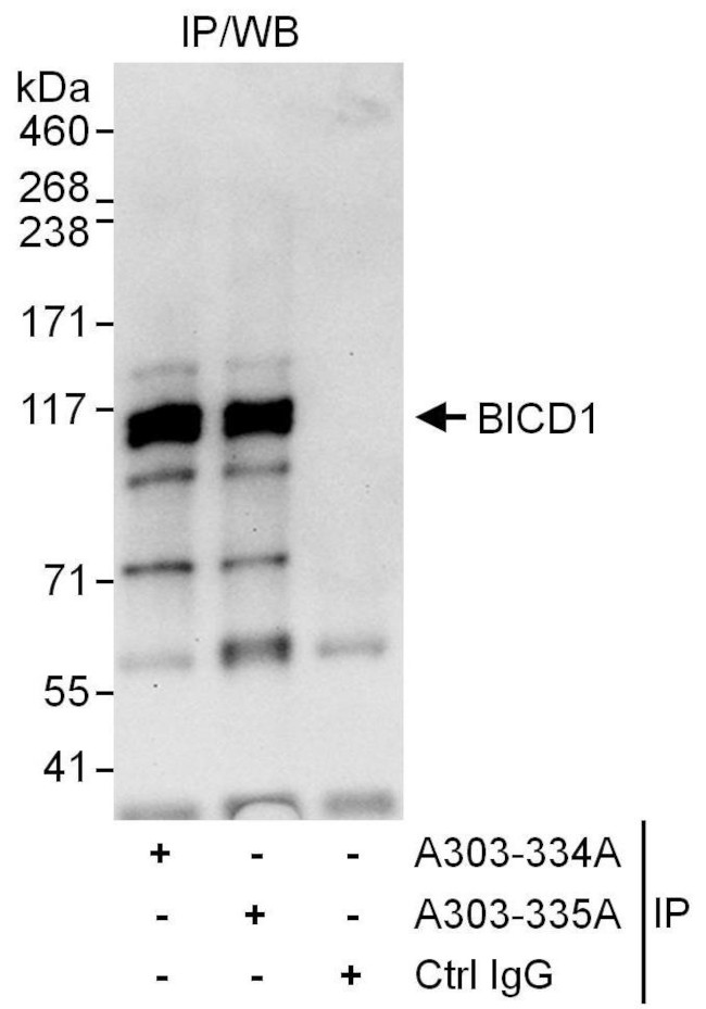 BICD1 Antibody in Immunoprecipitation (IP)