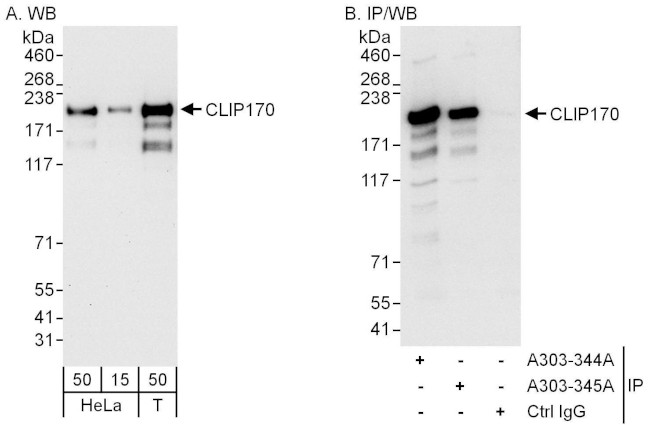 CLIP170 Antibody in Western Blot (WB)