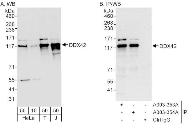 DDX42 Antibody in Western Blot (WB)