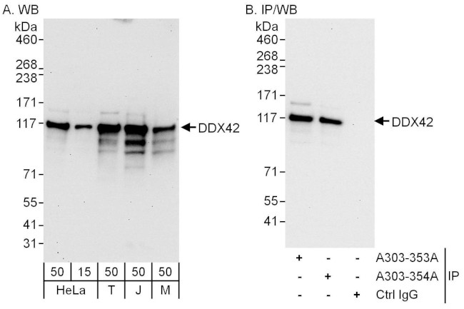 DDX42 Antibody in Western Blot (WB)