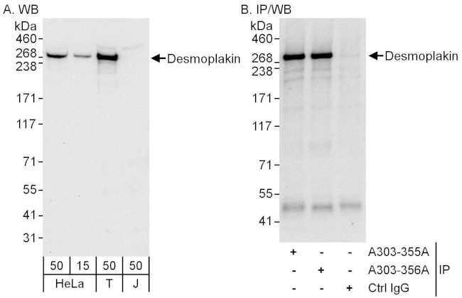 Desmoplakin Antibody in Western Blot (WB)