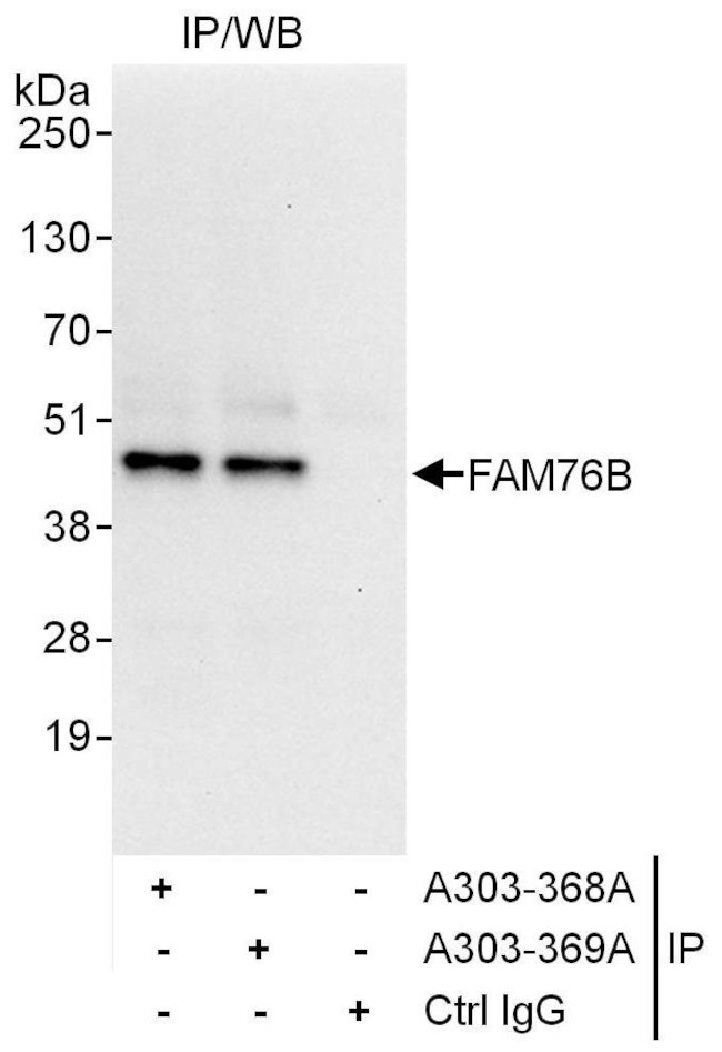 FAM76B Antibody in Immunoprecipitation (IP)