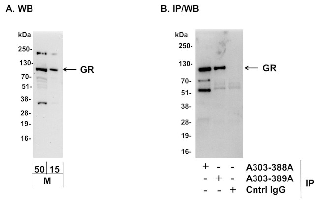 GR Antibody in Western Blot (WB)