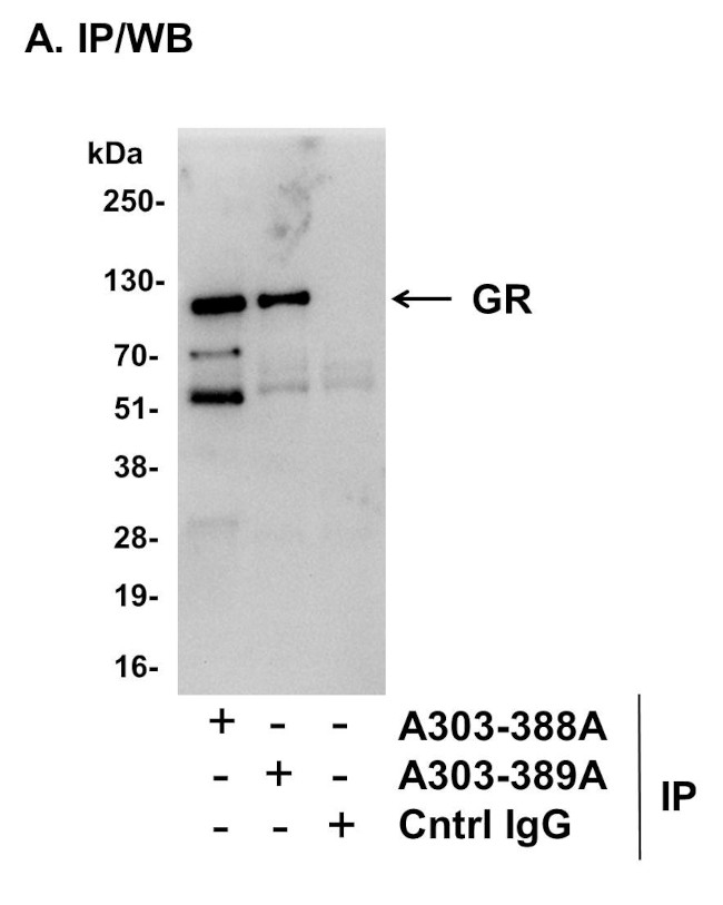 GR Antibody in Immunoprecipitation (IP)