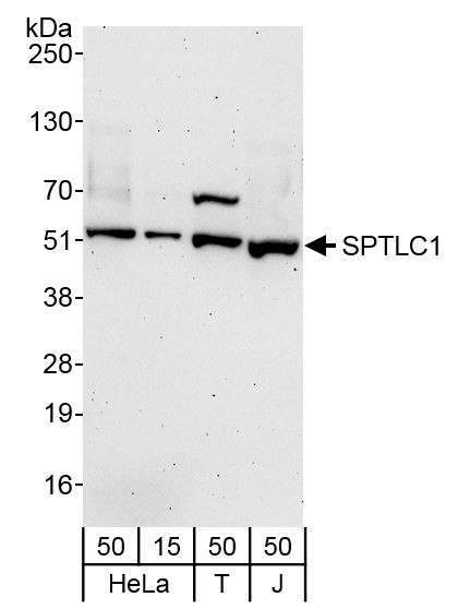 SPTLC1 Antibody in Western Blot (WB)