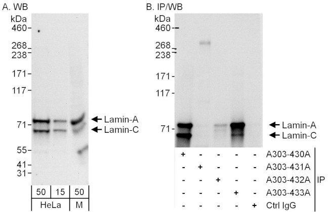 Lamin-A/C Antibody in Western Blot (WB)