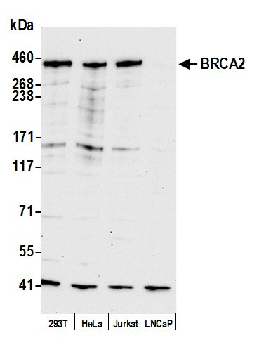 BRCA2 Antibody in Western Blot (WB)