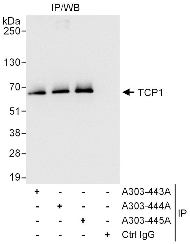 TCP1 Antibody in Immunoprecipitation (IP)