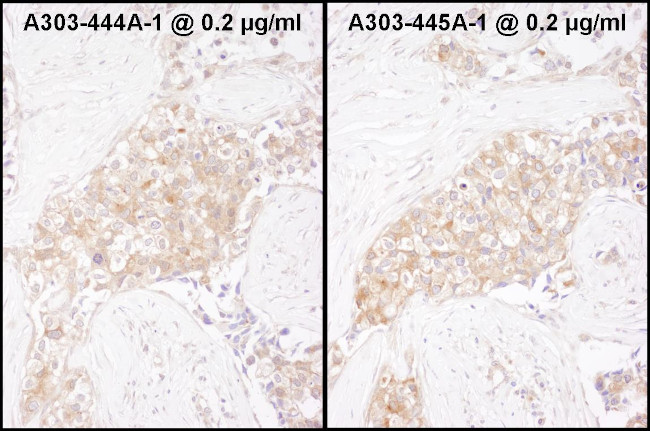 TCP1 Antibody in Immunohistochemistry (Paraffin) (IHC (P))