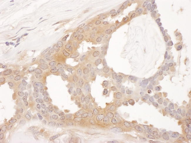 CCT8 Antibody in Immunohistochemistry (Paraffin) (IHC (P))