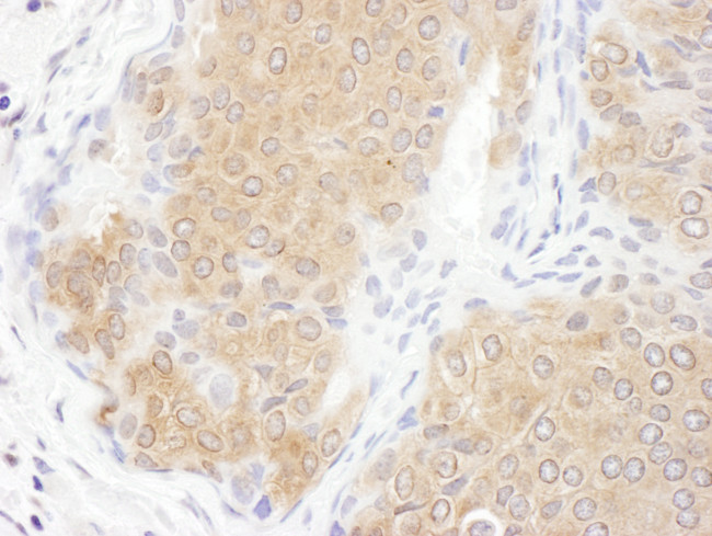 CCT3 Antibody in Immunohistochemistry (Paraffin) (IHC (P))