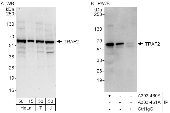 TRAF2 Antibody in Western Blot (WB)