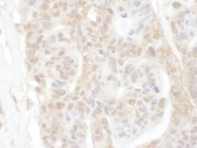 ROC1 Antibody in Immunohistochemistry (Paraffin) (IHC (P))