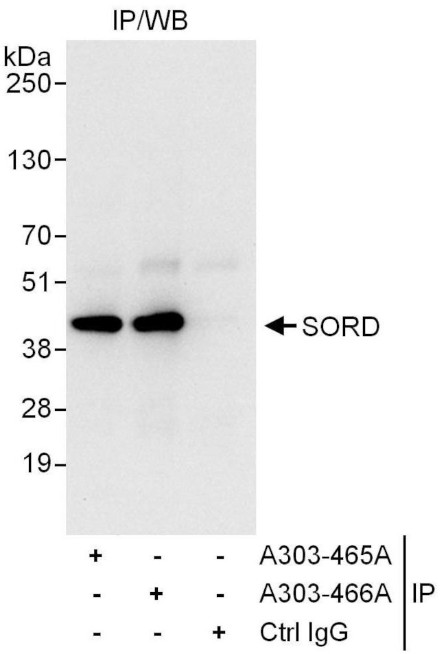 SORD Antibody in Immunoprecipitation (IP)