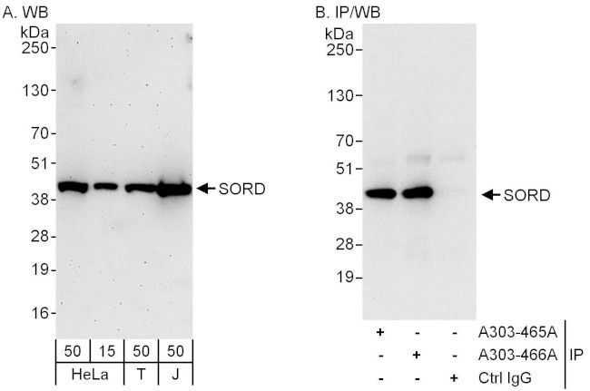 SORD Antibody in Western Blot (WB)