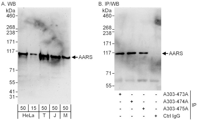 AARS Antibody in Western Blot (WB)