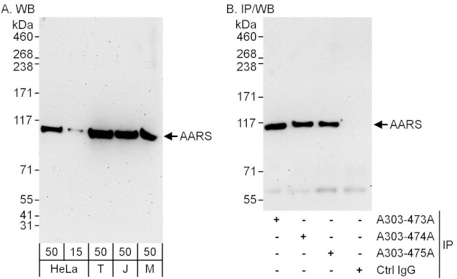 AARS Antibody in Western Blot (WB)