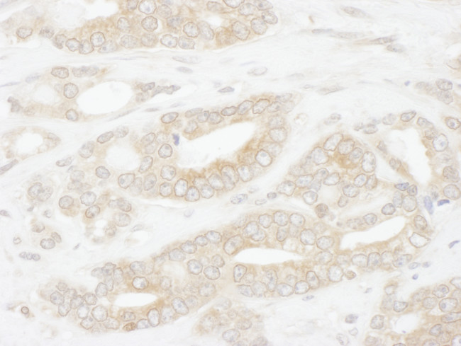 CCT2 Antibody in Immunohistochemistry (Paraffin) (IHC (P))