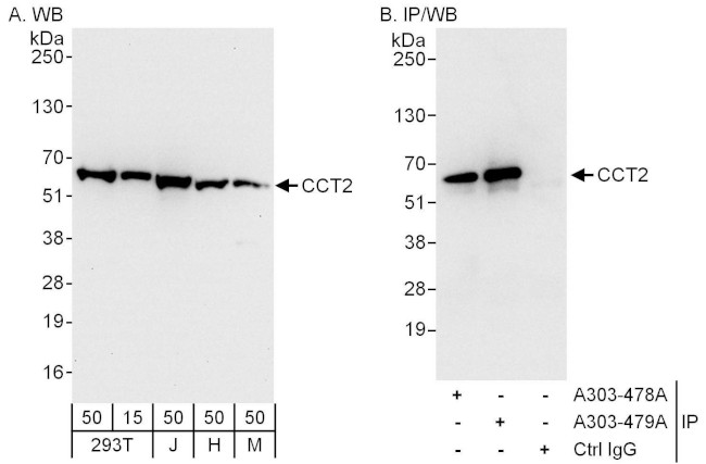 CCT2 Antibody in Western Blot (WB)