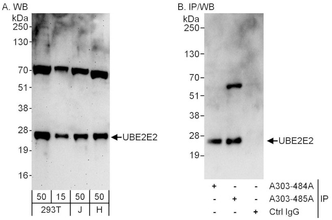 UBE2E2 Antibody in Western Blot (WB)