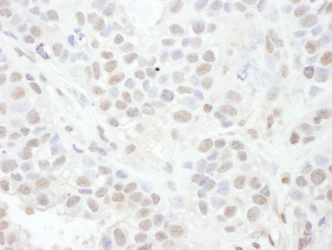 LEF1 Antibody in Immunohistochemistry (Paraffin) (IHC (P))