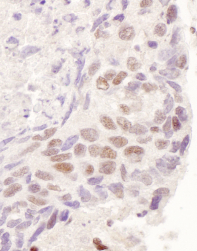 GR Antibody in Immunohistochemistry (Paraffin) (IHC (P))